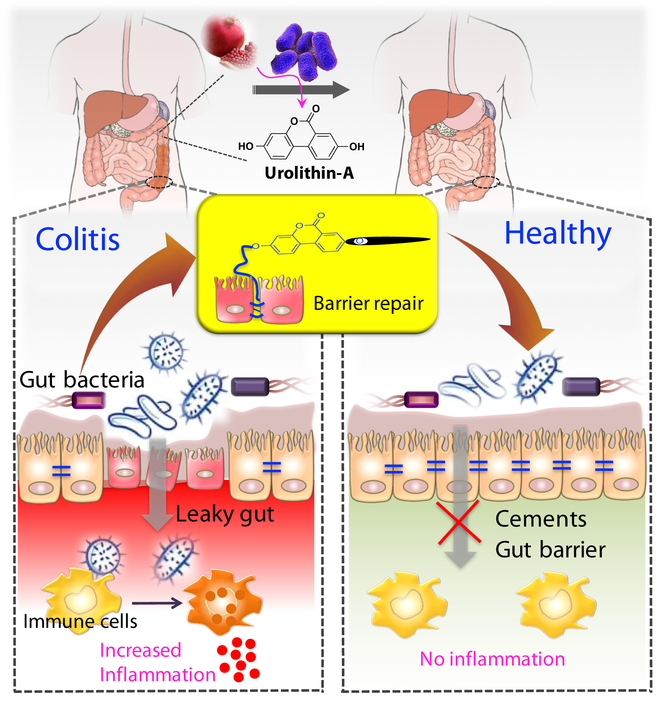 Urolithin-A repairs the gut barrier dysfunction